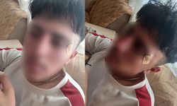 Öğretmen kafa attı, öğrencinin burnu kırıldı