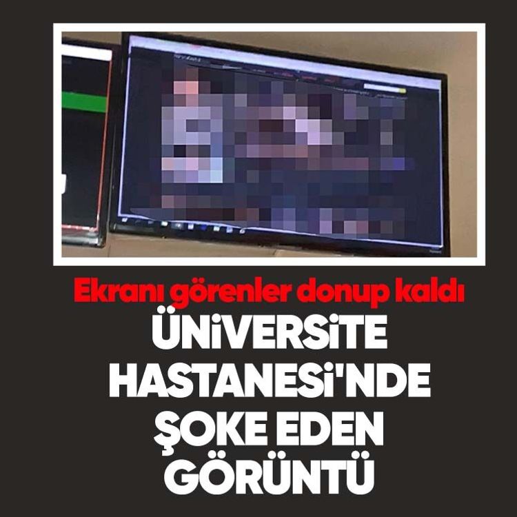 Üniversite Hastanesi'nde şoke eden görüntü.. Ekranı görenler donup kaldı
