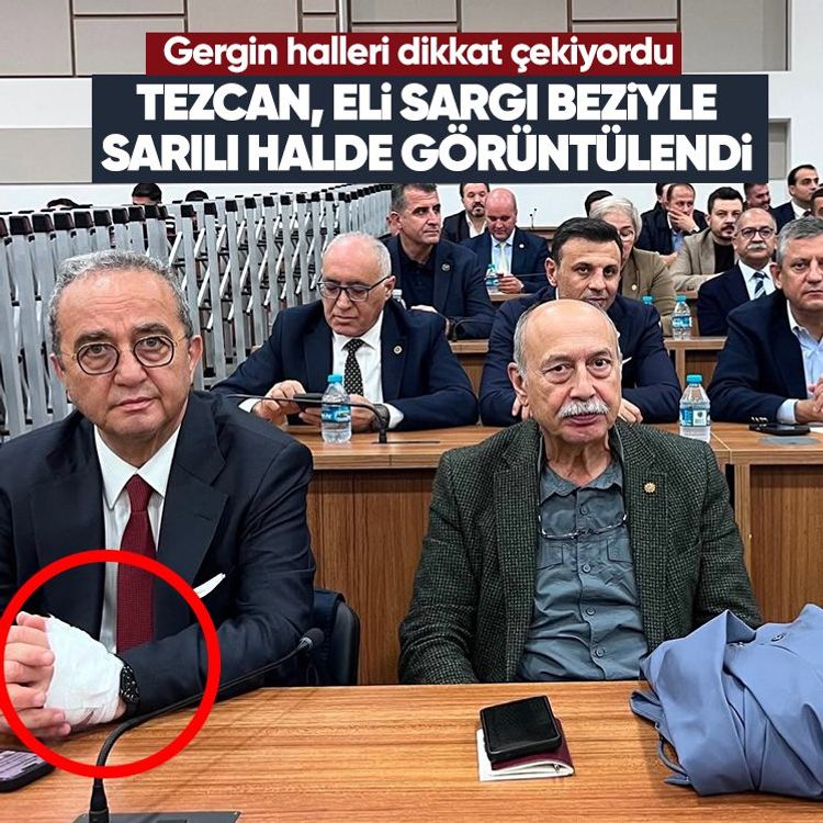 Gergin halleri dikkat çekiyordu: Tezcan, eli sargı beziyle sarılı halde görüntülendi