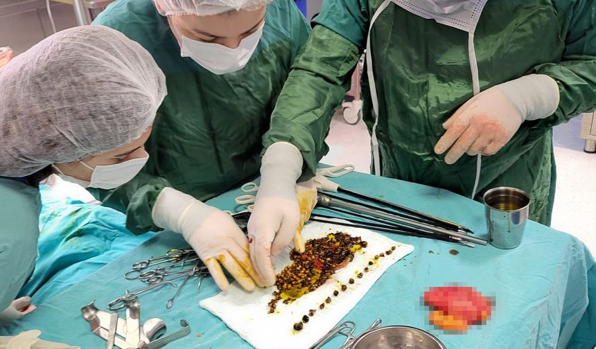 Karın ağrısıyla gitti, karnından çıkanlar doktorları da şaşırttı