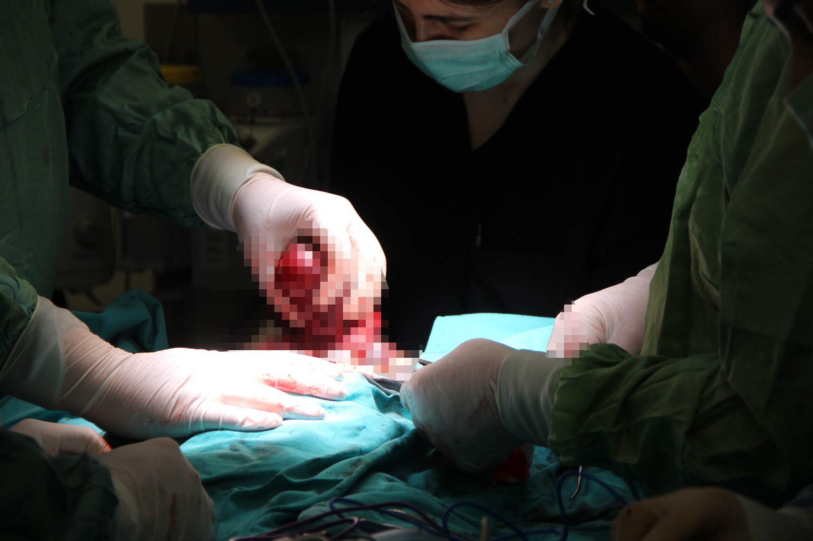 Boynunda Dev Tümörle Doğan Bebek Hayata Tutundu (6)