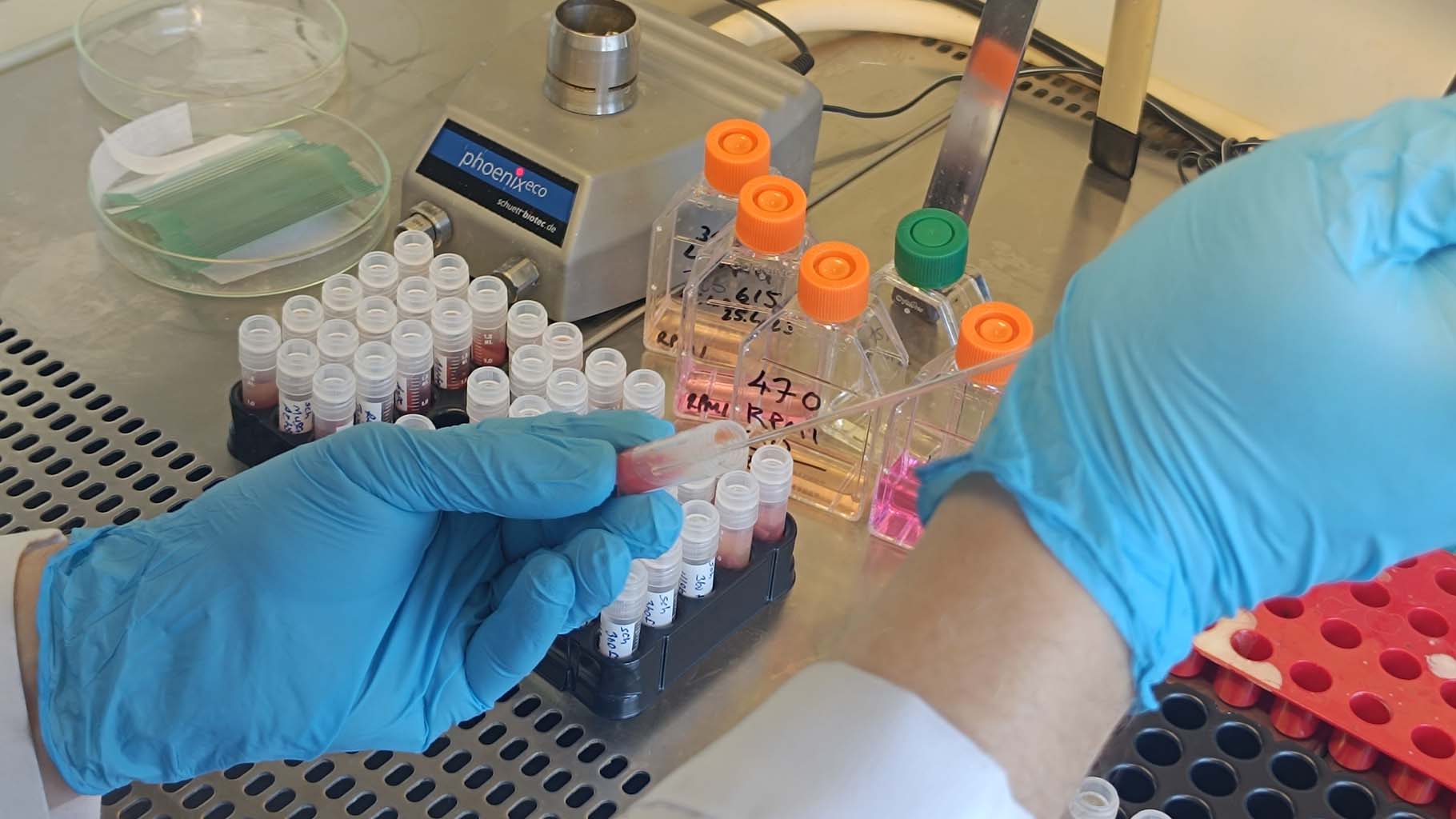 Uzmanlardan 'Yakarca' Uyarısı (2)-1