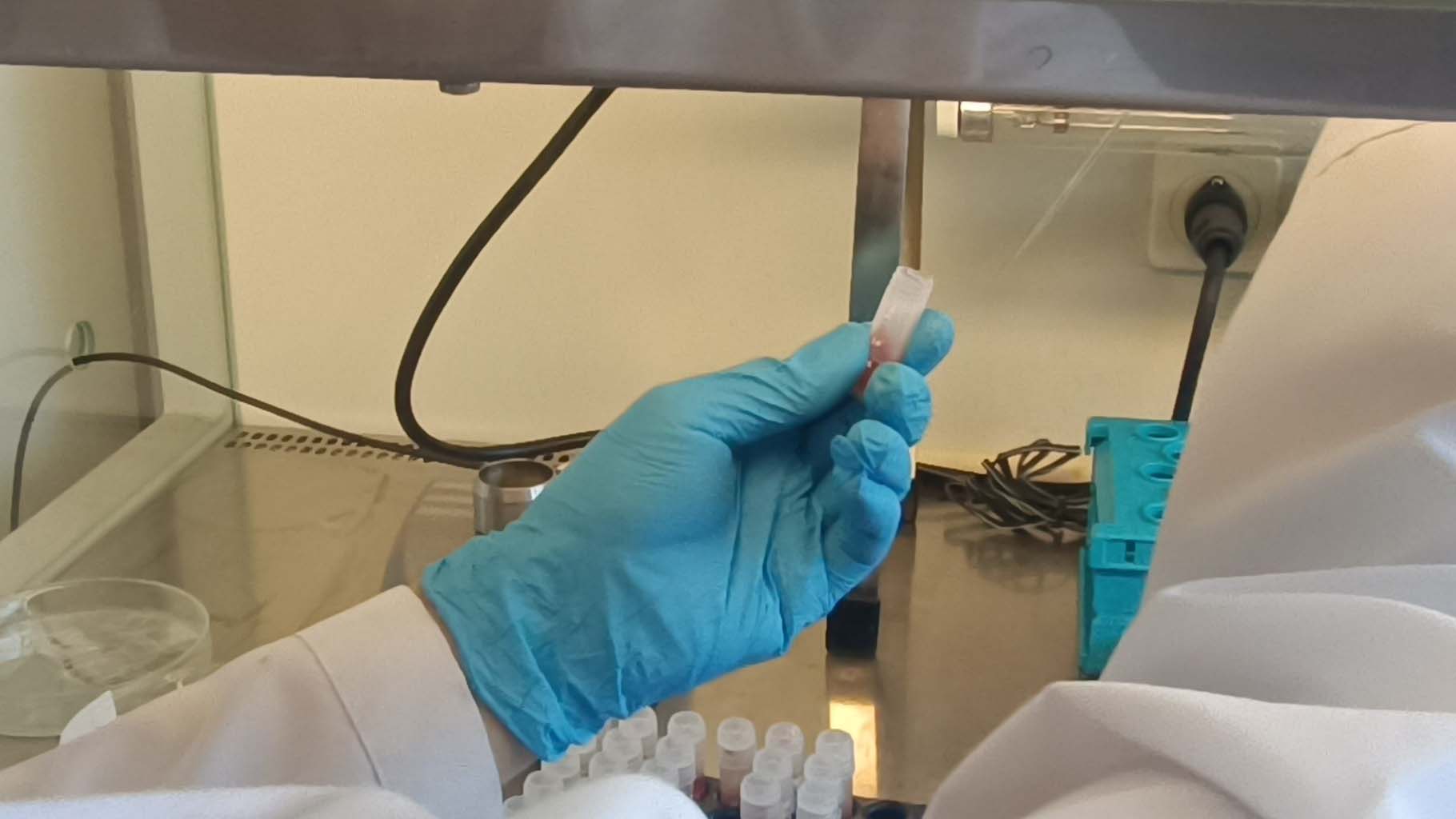 Uzmanlardan 'Yakarca' Uyarısı (4)-1