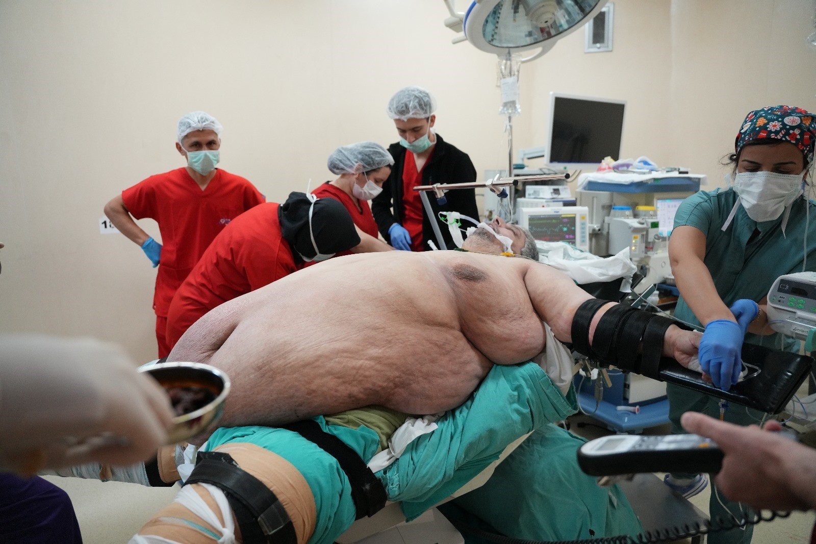 Aydın’da Yaşandı.. 310 Kiloyla Hastaneye Geldi, Yürüyerek Taburcu Oldu (2)