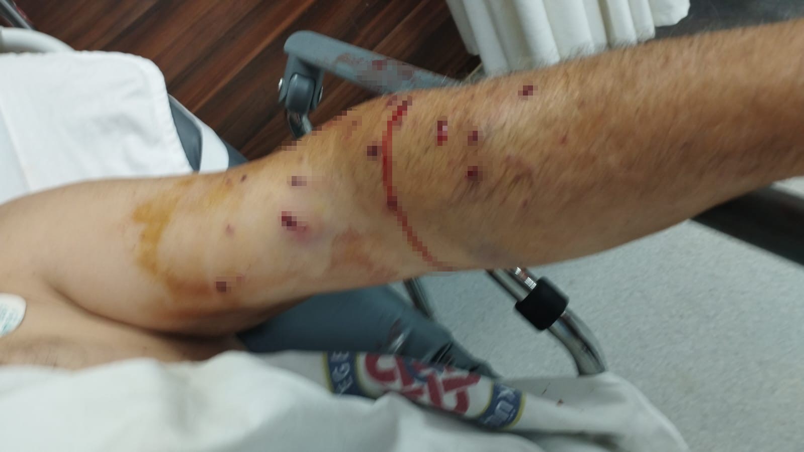 180 Liralık Kantar Ücreti Için Çalışanı Vurdu (2)