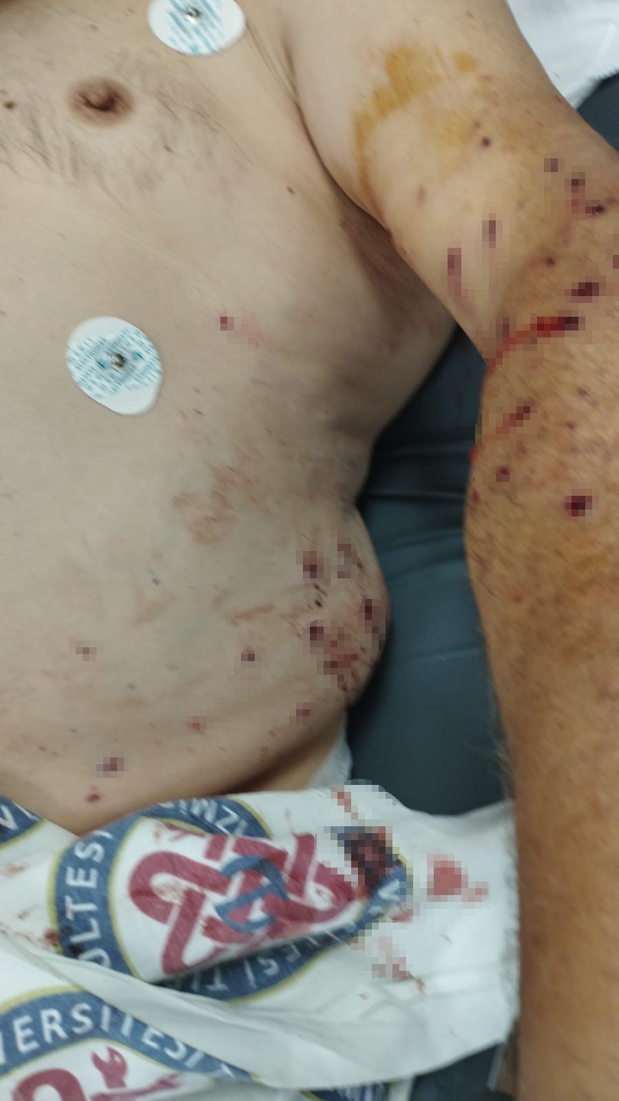 180 Liralık Kantar Ücreti Için Çalışanı Vurdu