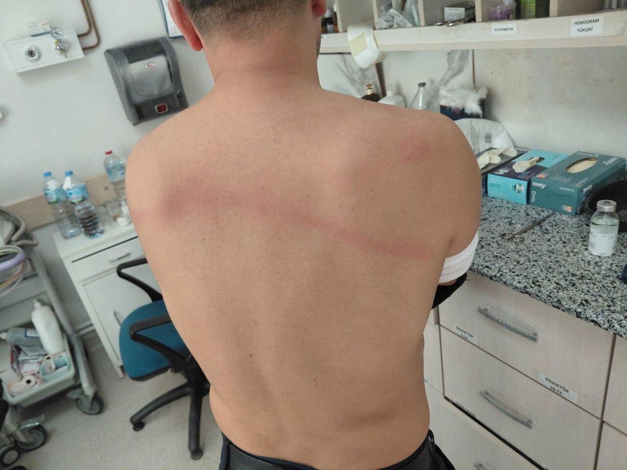 Belediye Başkanı Taş Döşemek Istemeyen Zabıtaları Sopayla Dövdü (11)