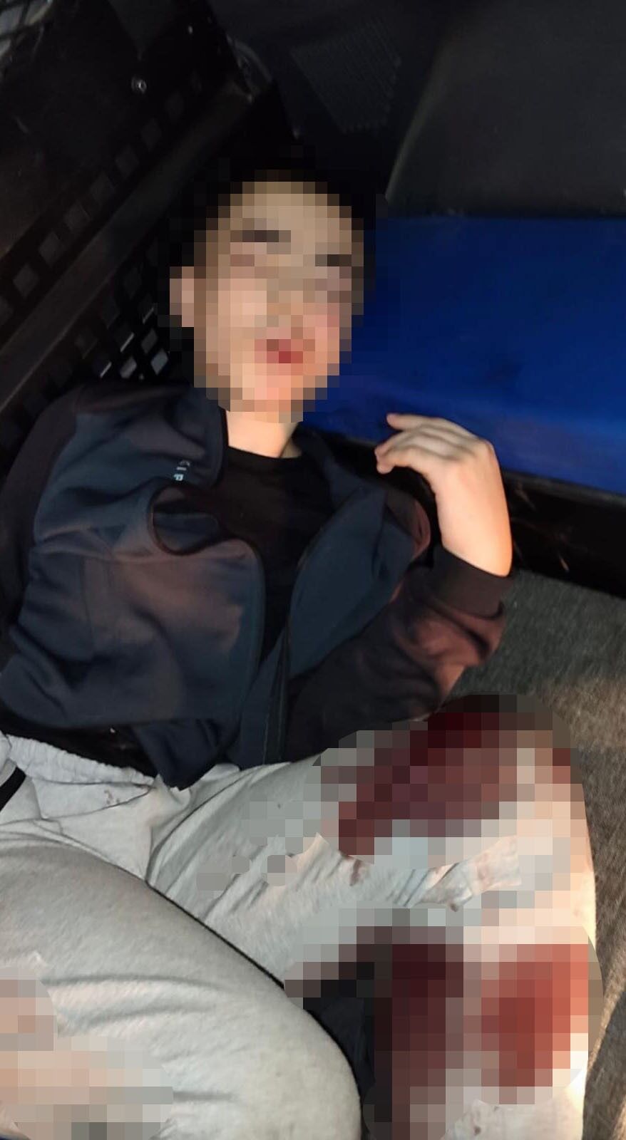 İzmir’deki Saldırgan Yaralı Olarak Yakalandı (2)