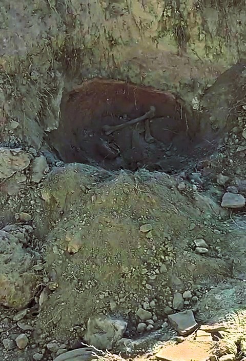 İnsana Ait Kemik Parçaları Bulundu (2)