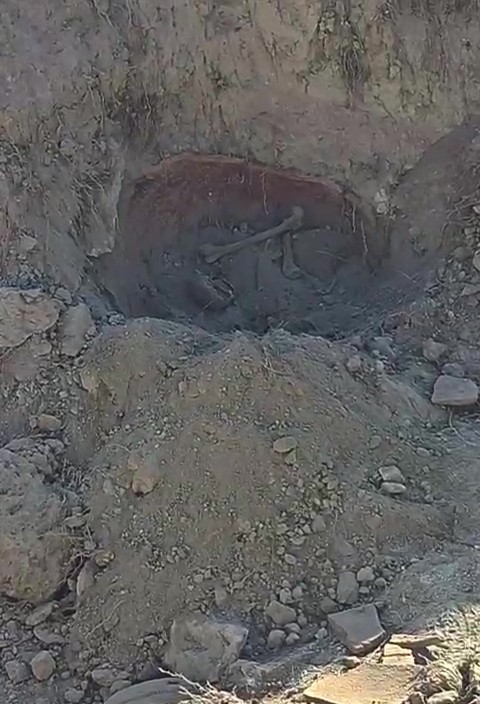 İnsana Ait Kemik Parçaları Bulundu (5)