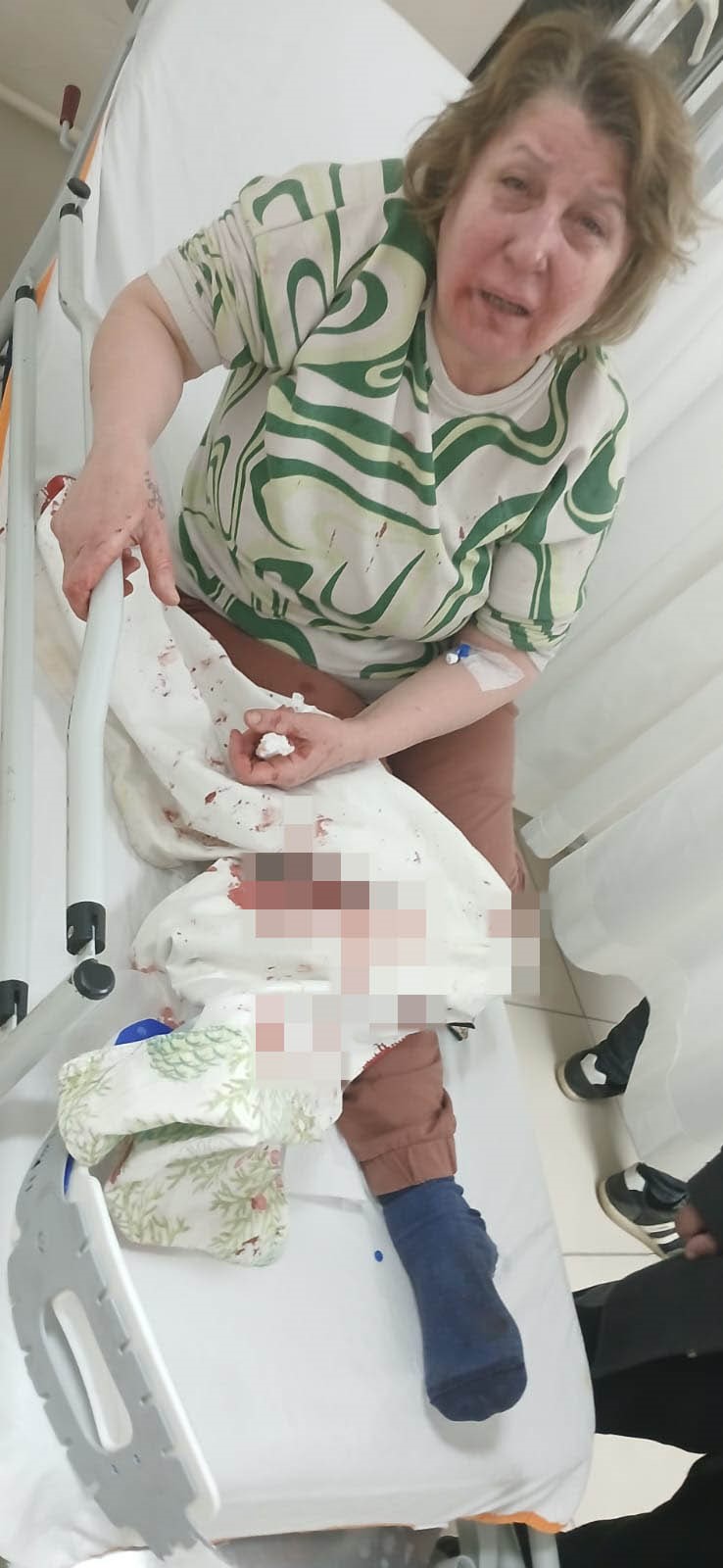 Polis Memuru Komşusunu Darp Etti (3)