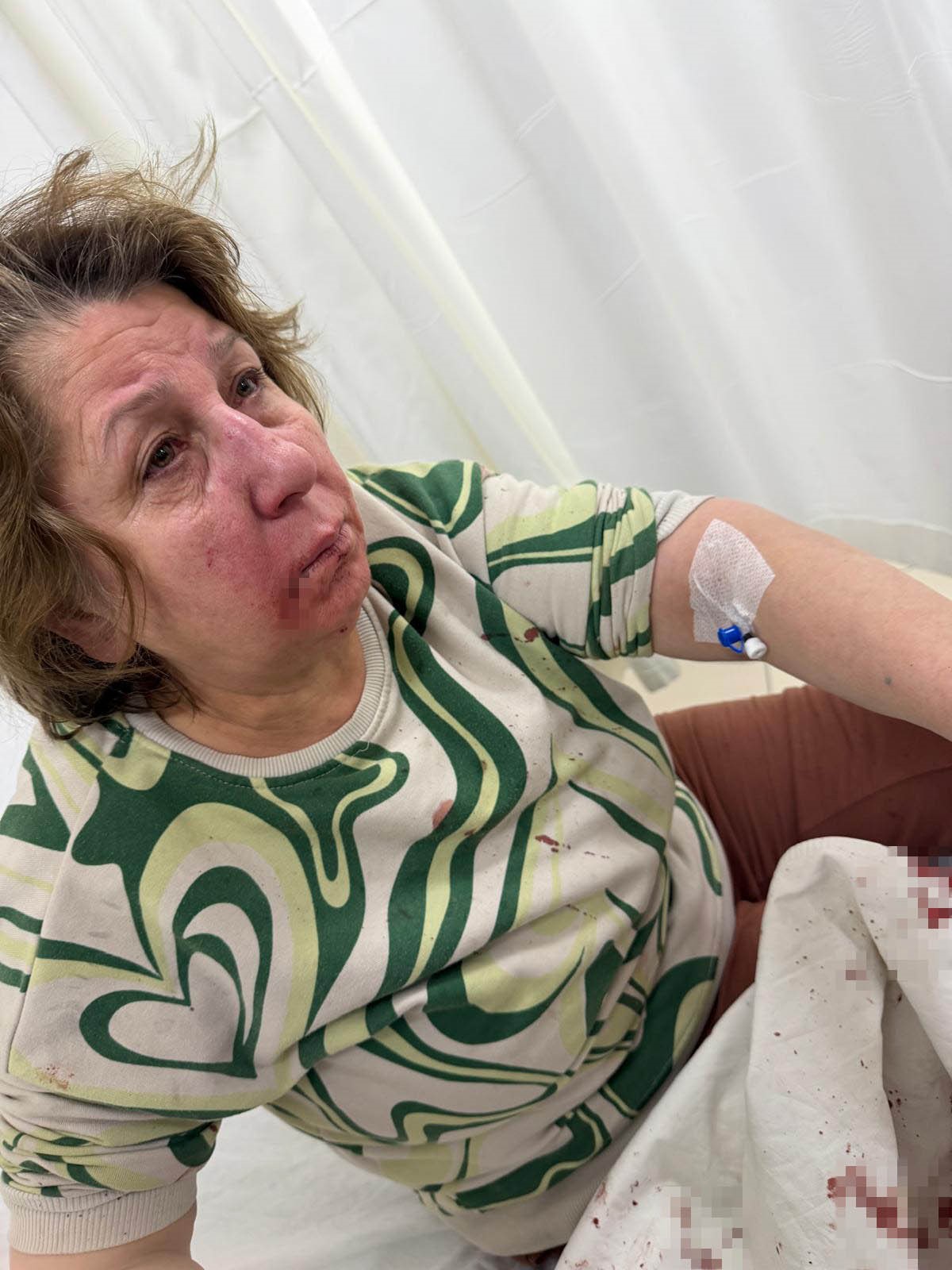 Polis Memuru Komşusunu Darp Etti (6)