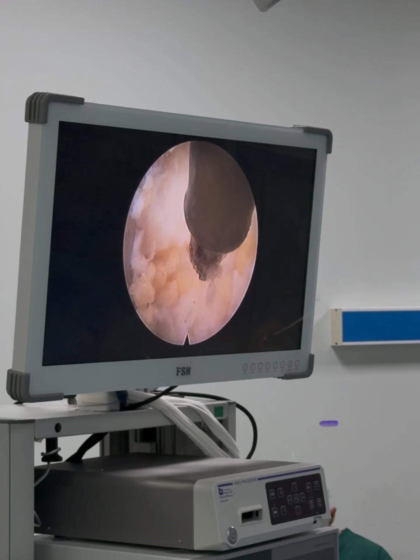 Aydın Adü Hastanesi’nde Ilk Kez Uygulanmaya Başladı (3)