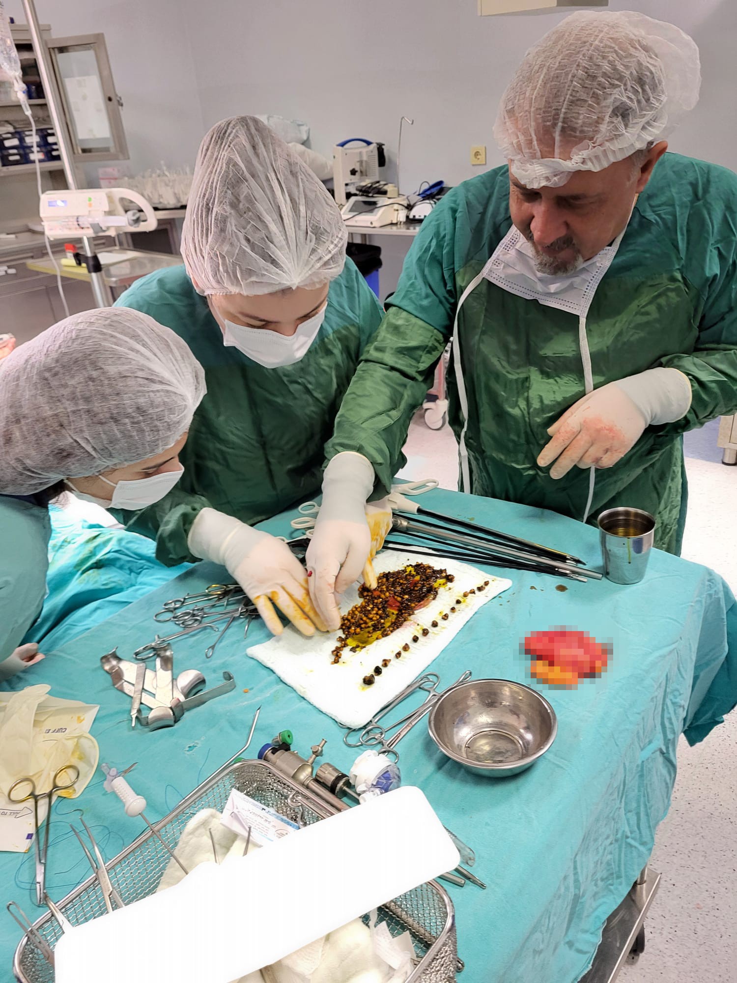 Karın Ağrısıyla Gitti, Karnından Çıkanlar Doktorları Da Şaşırttı (1)