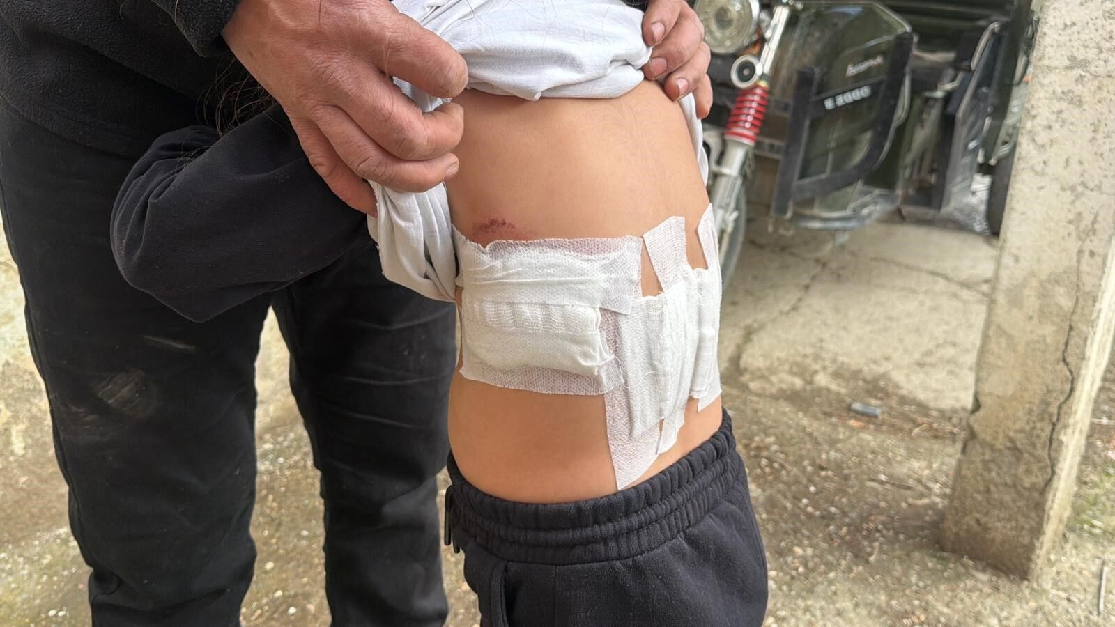 5 Yaşındaki Çocuğa Eşek Saldırdı (2)