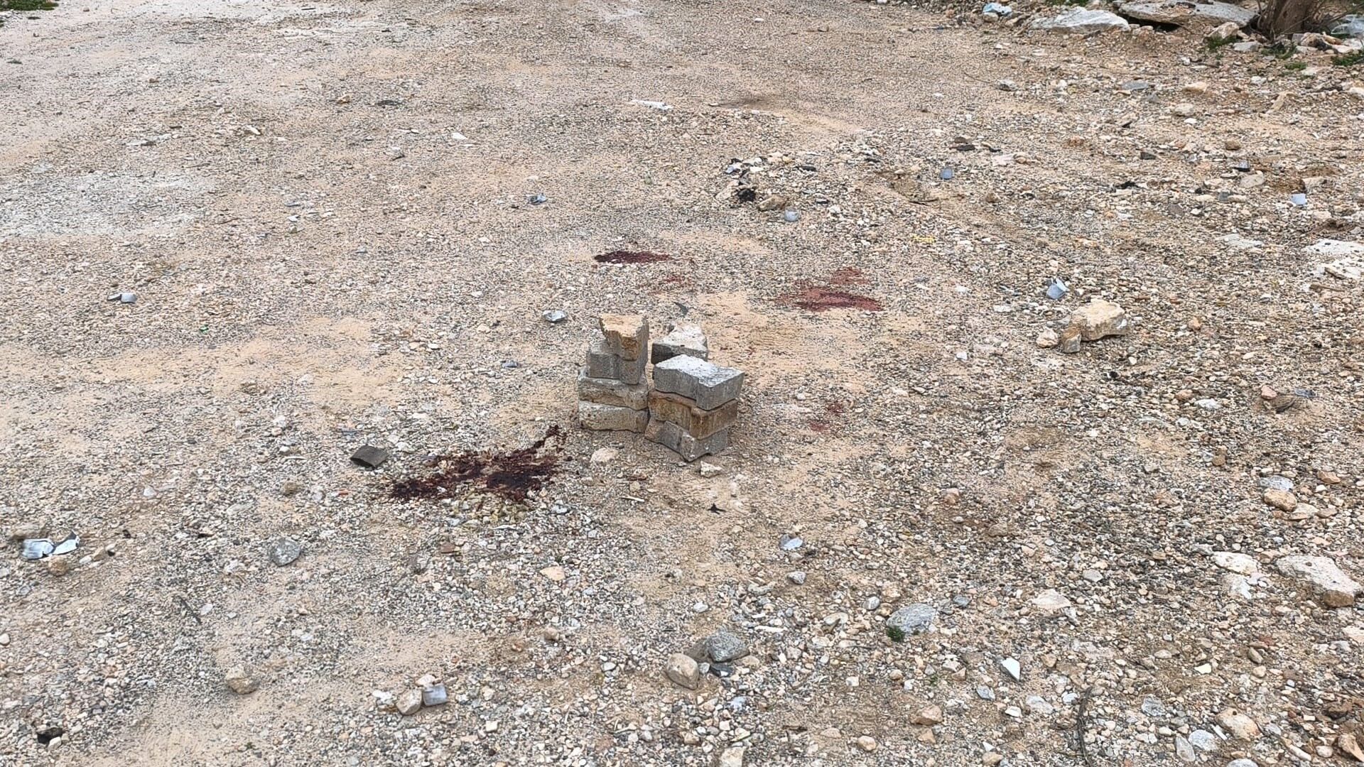 Ramazan Topu 19 Yaşındaki Gencin Yüzünde Patladı (1)