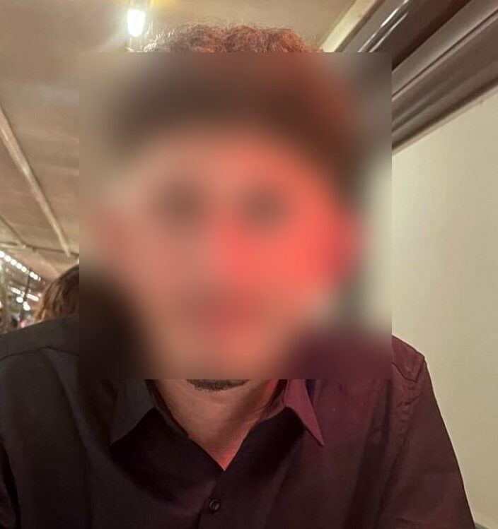 Ramazan Topu 19 Yaşındaki Gencin Yüzünde Patladı (2)