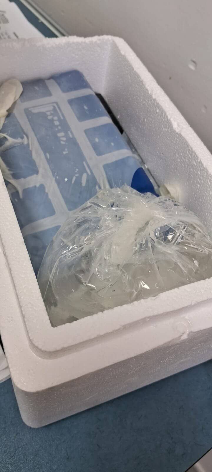 Başıboş Köpeklerin Saldırısına Uğrayan Adamın Baş Parmağı Koptu (5)