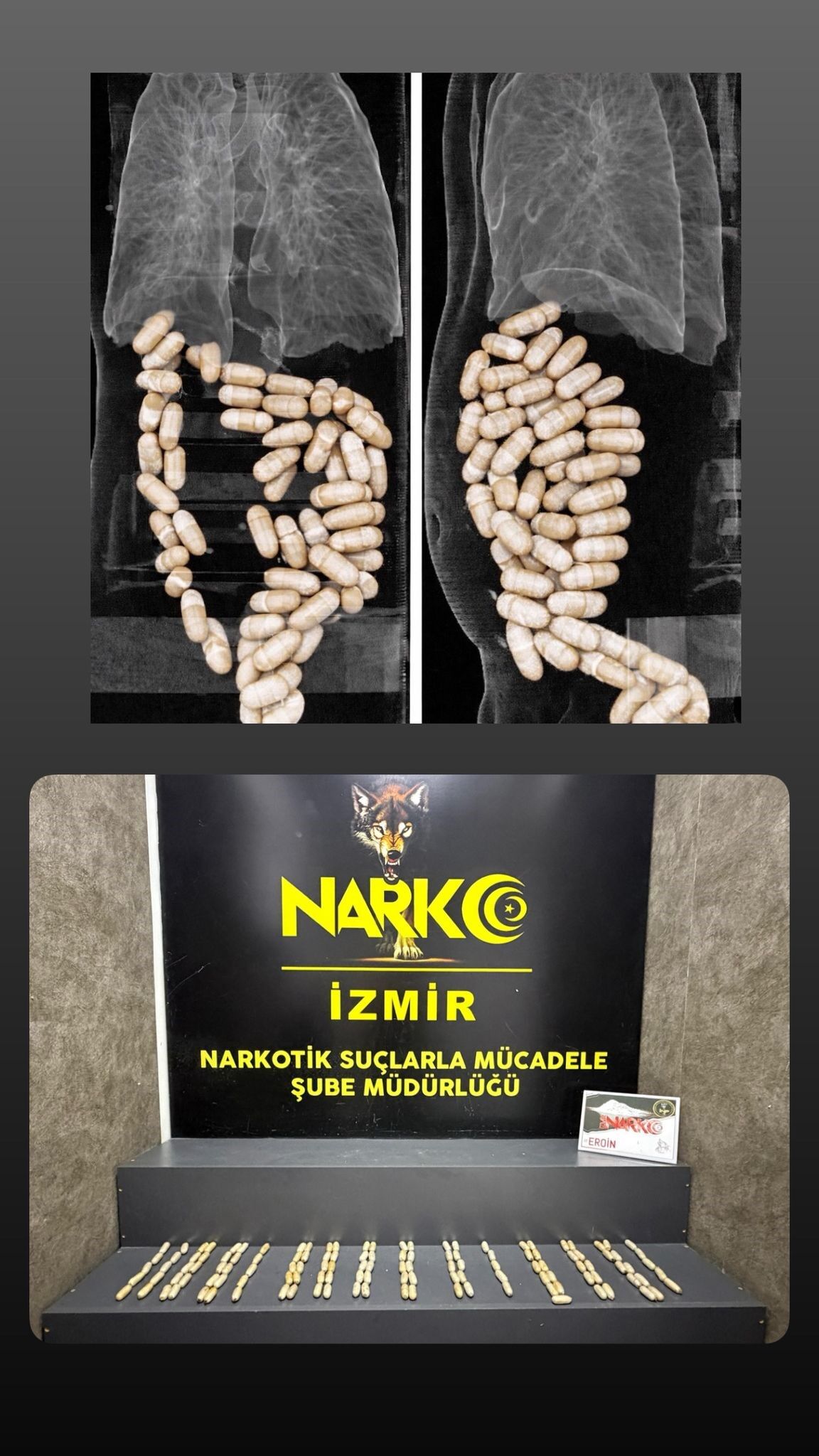 Polis Midelerinde Yakaladı (2)