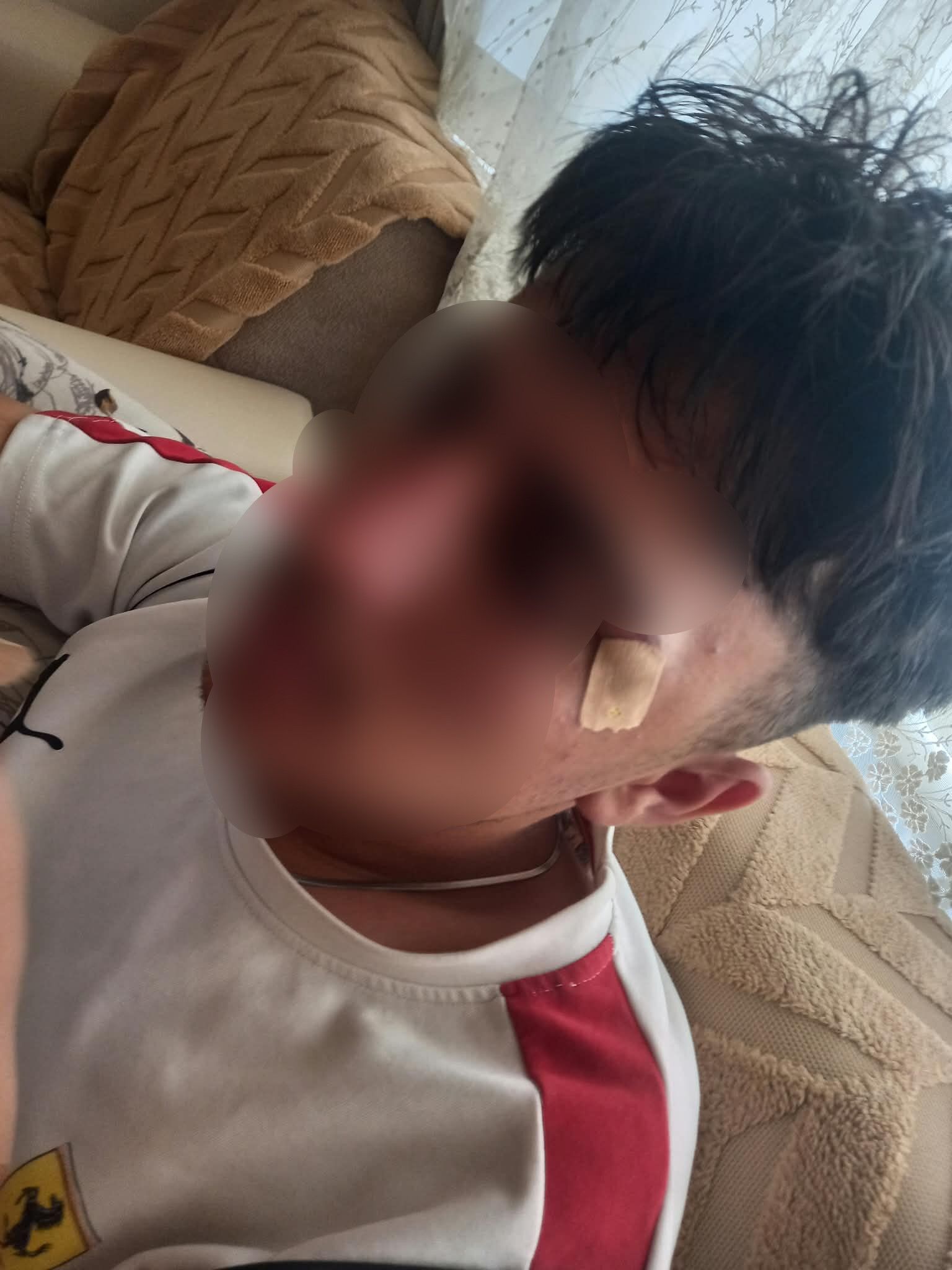 Öğretmen Kafa Attı, Öğrencinin Burnu Kırıldı (2)
