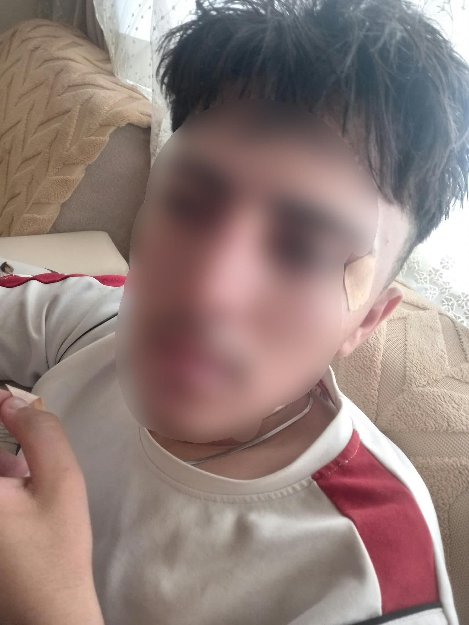 Öğretmen Kafa Attı, Öğrencinin Burnu Kırıldı (3)